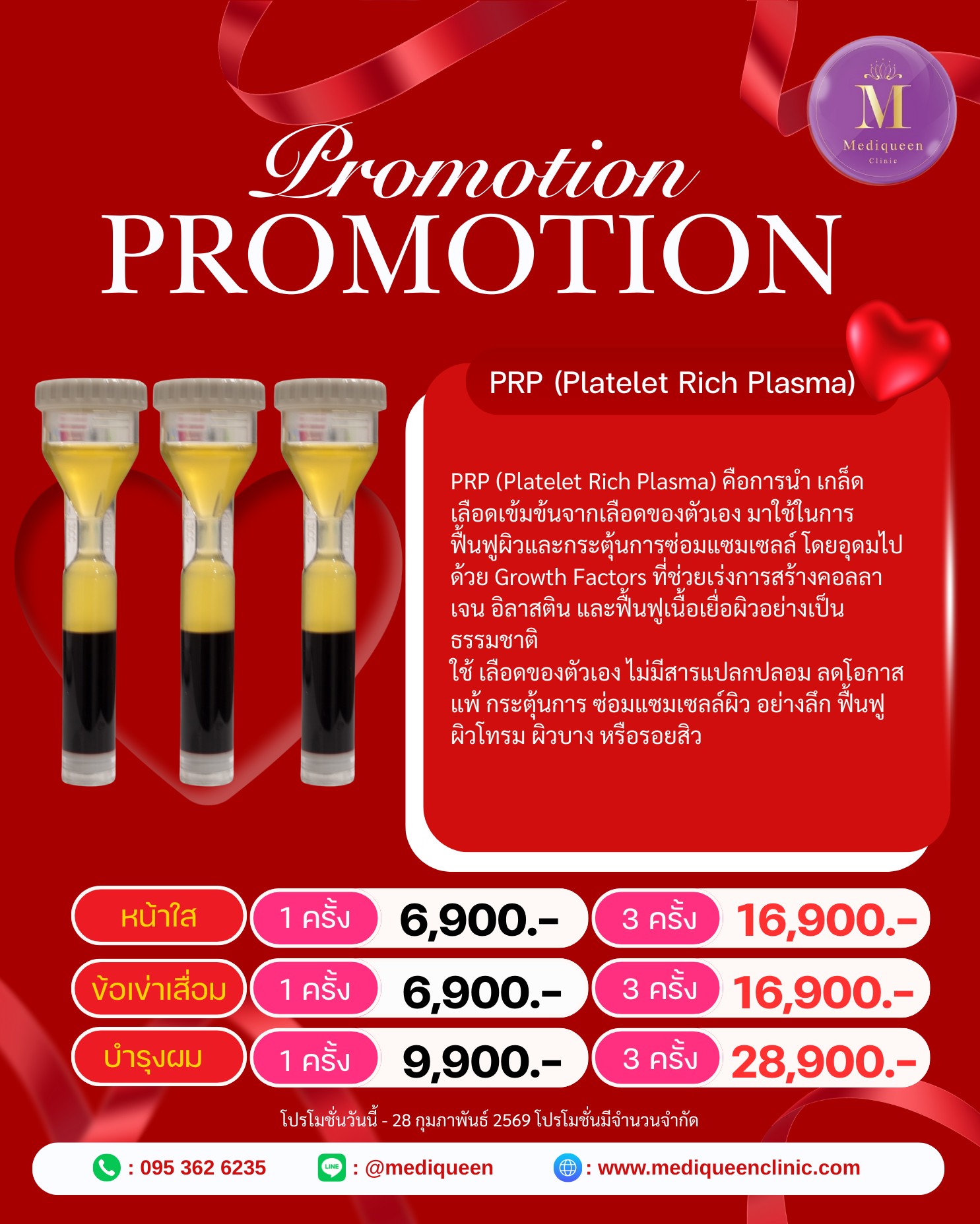 Promotion 10