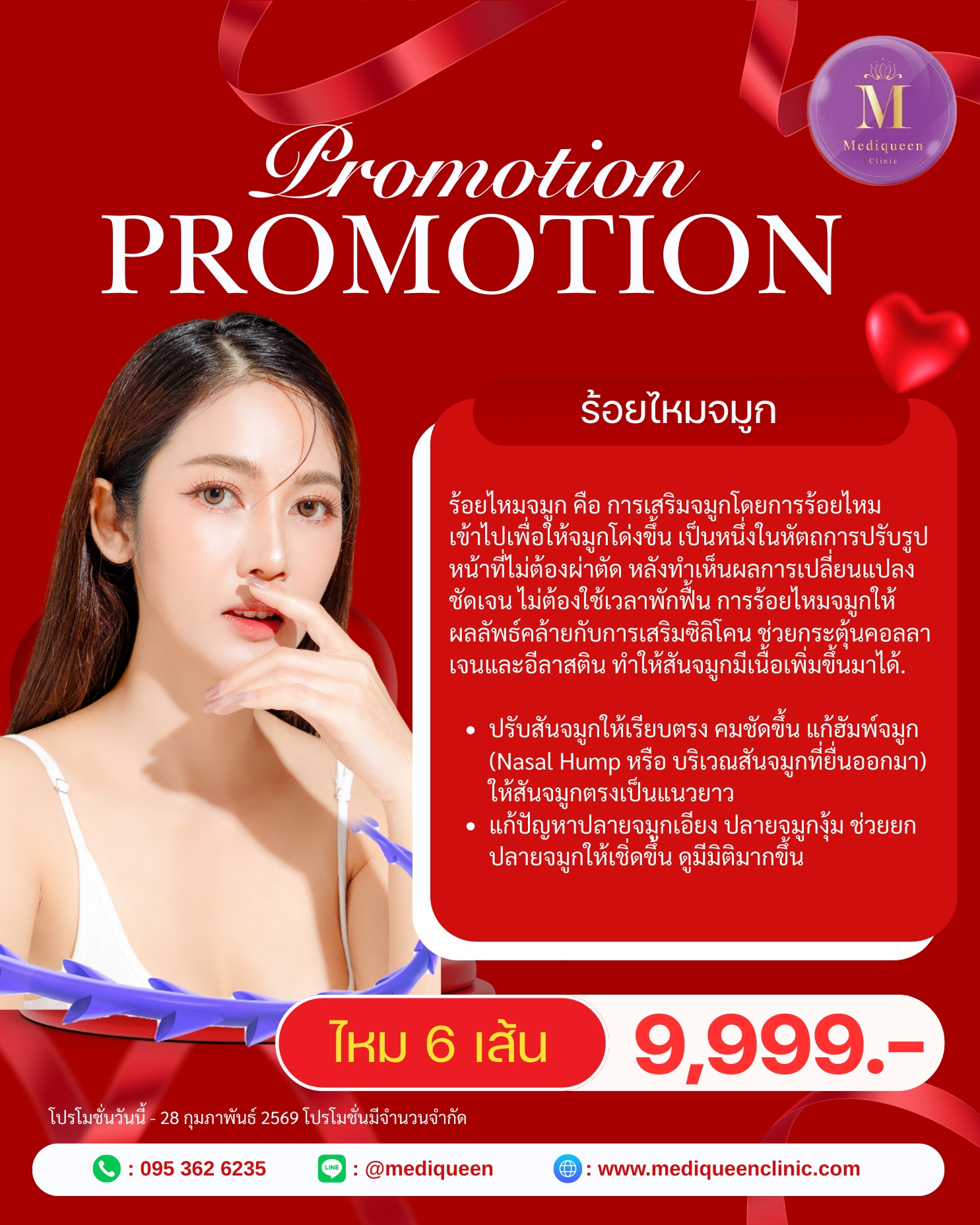 Promotion 12